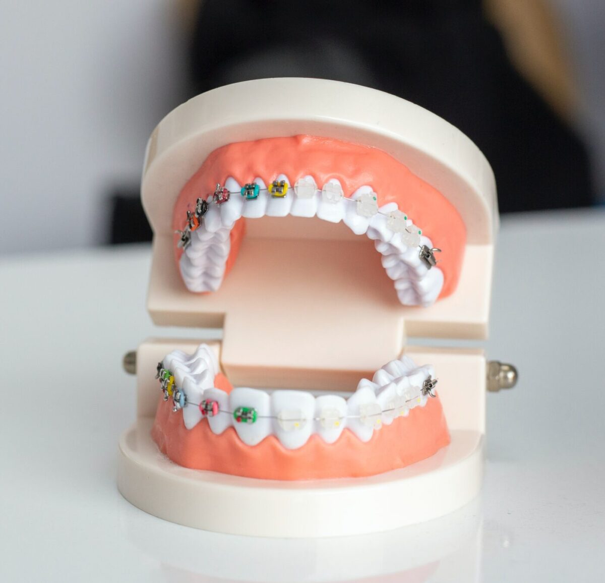 Achieve a straight and confident smile with orthodontic device solutions.