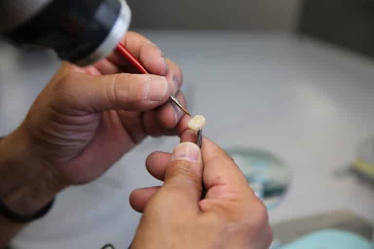 Close-up of a technician hand-crafting a porcelain dental crown, applying final details for superior aesthetics and a natural look.