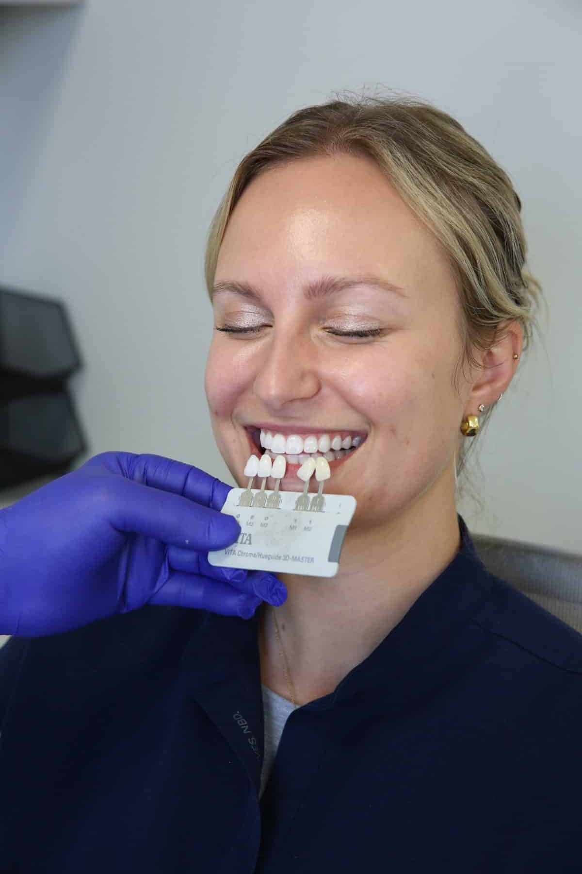 Dental Lab Near Me Dental professional performing personalized shade matching on a patient using a VITA shade guide to ensure custom veneers or crowns perfectly match the natural smile.
