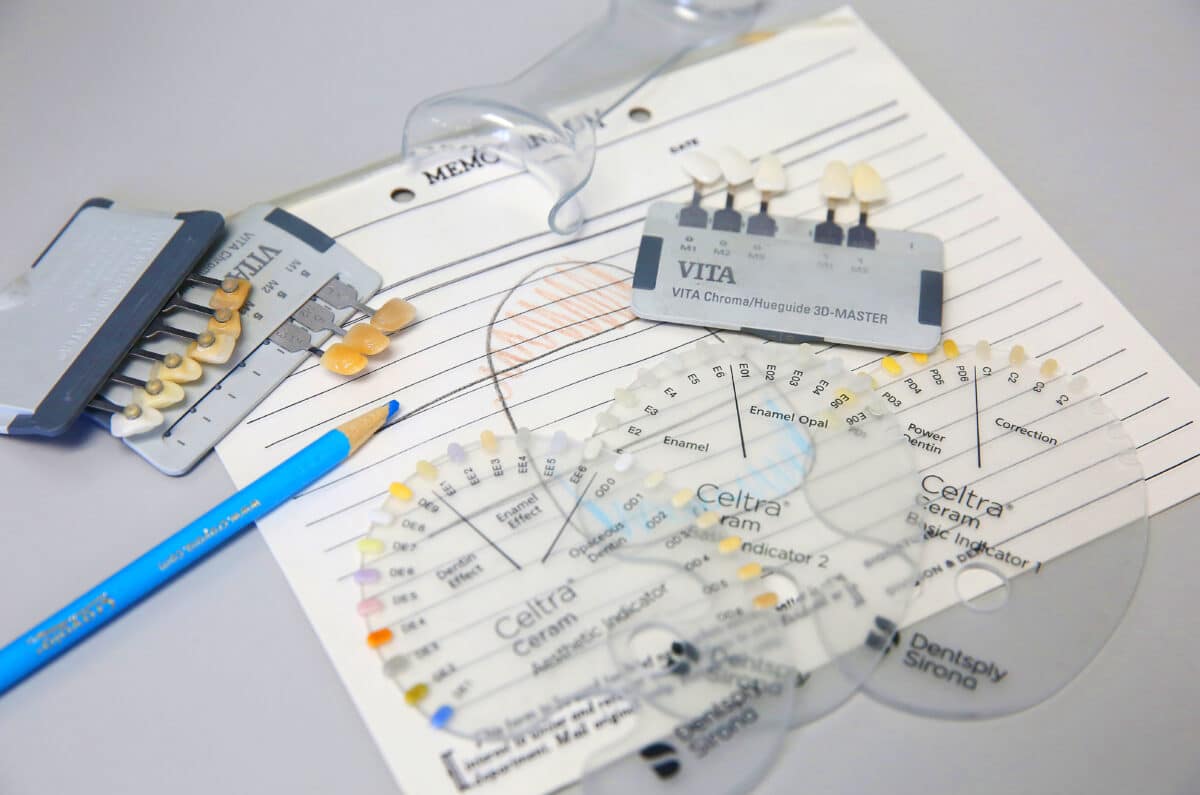 VITA and Celtra dental crown shade guides and aesthetic indicators used for precise color matching and material selection for custom dental crowns and bridges.